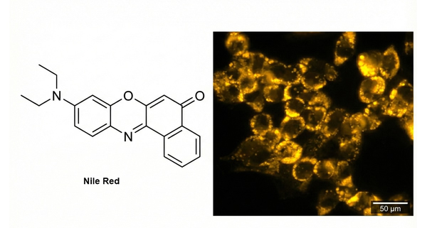 Nile Red structure with yellow fluorescent lipids.