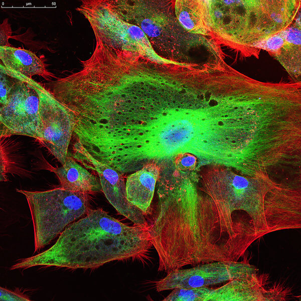 How Fluorescent Protein Labeling Supports Biopharmaceutical Research