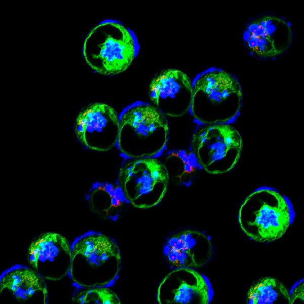 Protein Fluorescent Labeling Troubleshooting: Low Signal, Aggregation, and High Background
