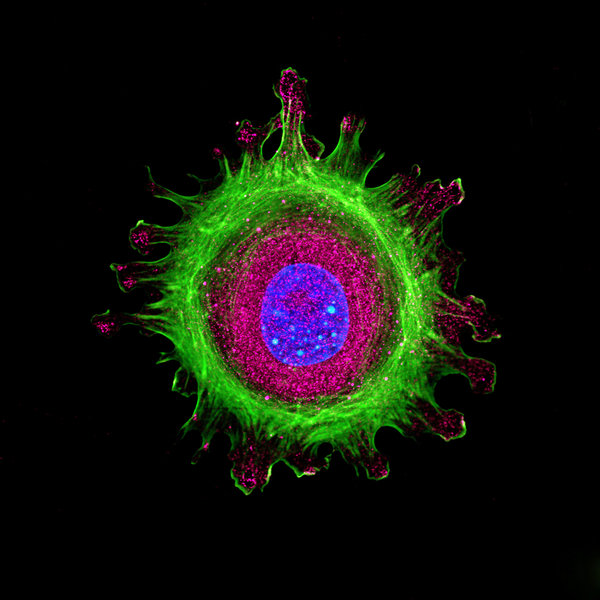 Protein Fluorescent Labeling Kits vs Custom Conjugation: Which Strategy Fits Your Workflow?
